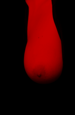 Breast